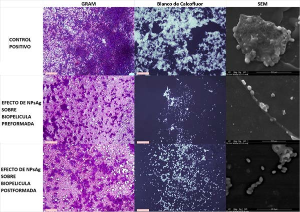 Comparación fotográfica de biopelículas bajo coloración de Gram, Blanco de Calcoflúor y SEM. El control positivo corresponde a biopelículas no sometidas a tratamiento con NPsAg.